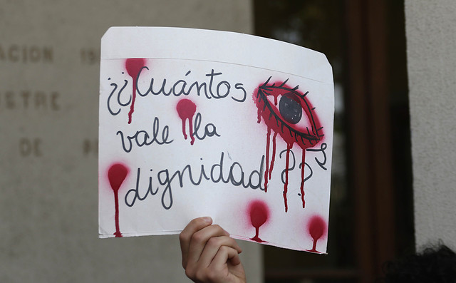  Víctima de pérdida ocular por impacto de bomba lacrimógena se querelló contra Piñera, Blumel y Rozas