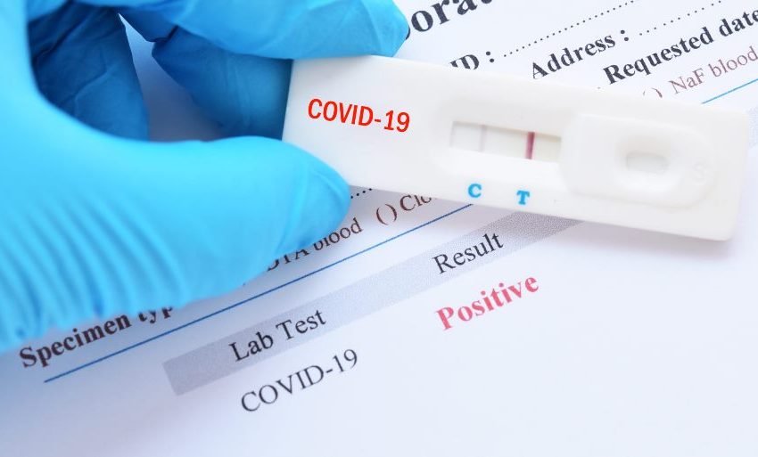  Centros de salud privados suspenden toma de exámenes PCR debido a “quiebre de stock disponible”