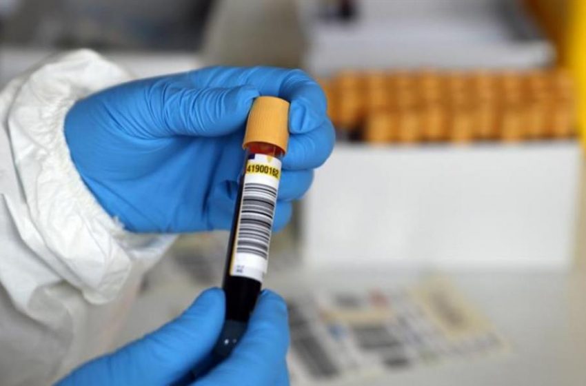  Gobierno anuncia que evalúa “expropiación” de patente a laboratorio para realizar exámenes PCR