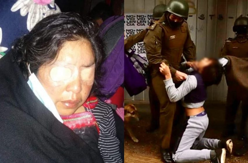  Denuncian desatada violencia represiva de Carabineros en Temuco